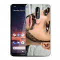 Дизайнерский силиконовый чехол для Nokia 3.2 drake