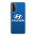 Дизайнерский силиконовый чехол для Huawei P Smart (2021) Hyundai