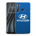 Дизайнерский пластиковый чехол для HTC Desire 20 Pro Hyundai