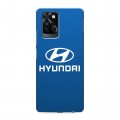 Дизайнерский силиконовый с усиленными углами чехол для Infinix Note 10 Pro Hyundai