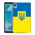 Дизайнерский силиконовый чехол для Realme Pad Mini Флаг Украины