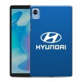 Дизайнерский силиконовый чехол для Realme Pad Mini Hyundai