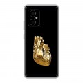 Дизайнерский силиконовый чехол для Xiaomi Poco M4 5G Черное золото
