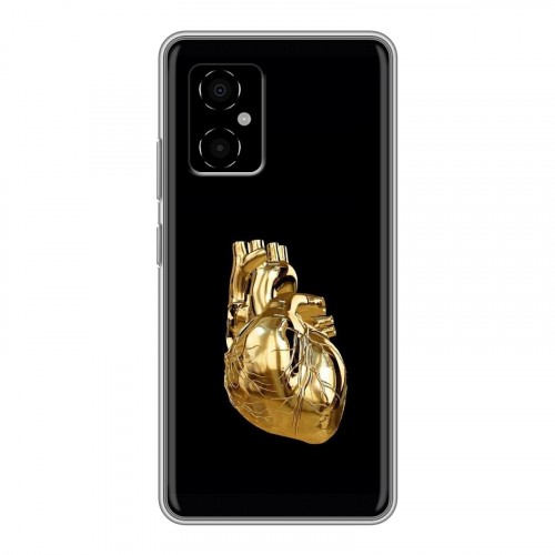 Дизайнерский силиконовый чехол для Xiaomi Poco M4 5G Черное золото